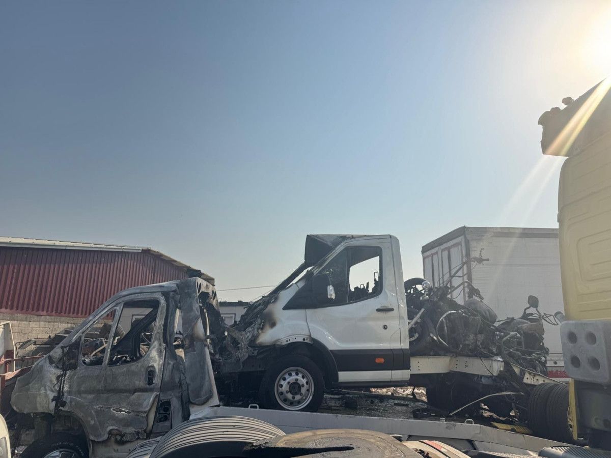 gaziantepte feci kazada bacaklarini kaybetti devamli tir ilerliyordu hic durmuyordu 3 MgZAdbKp