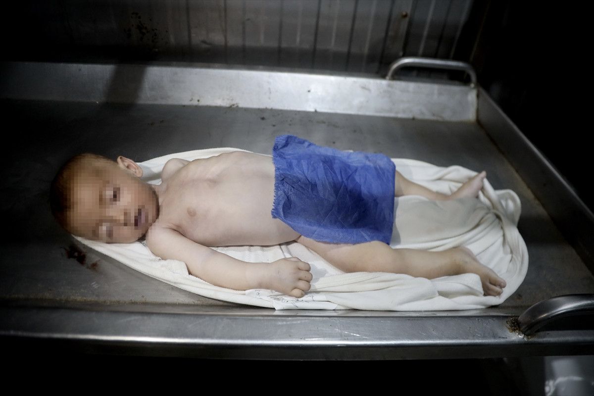 gazzede 2 bebek daha acliktan hayatini kaybetti 4 p4IcsGZ1