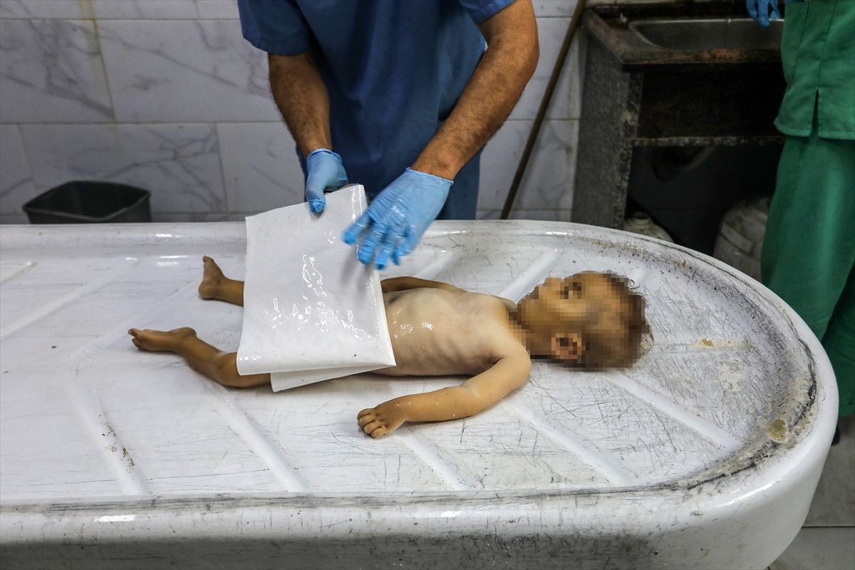 gazzede 2 bebek daha acliktan hayatini kaybetti 7 5sj68rpU