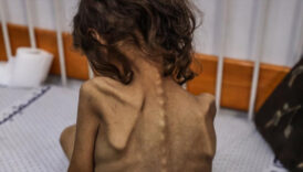 gazzede 5 filistinli daha aclikta yasamini yitirdi uxMO6v3x