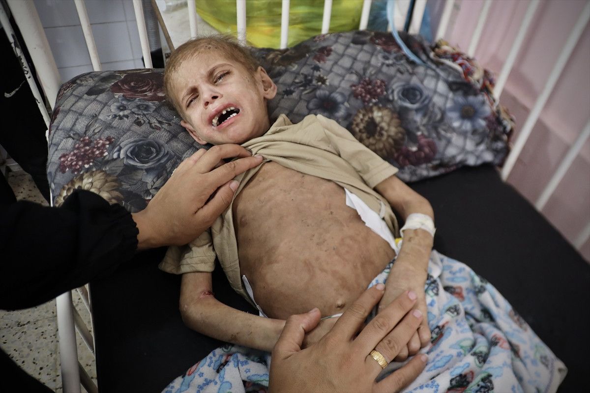 gazzede aci tablo 7 yasindaki mey saglik sorunlariyla mucadele ediyor 5 meGeHT4M