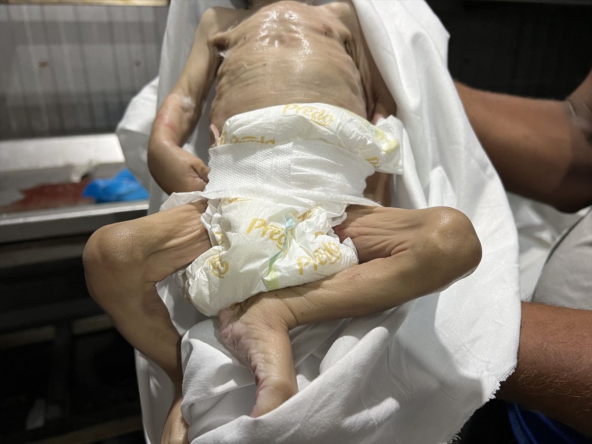 gazzede bir bebek daha acliktan oldu 0 KfXOpXeZ