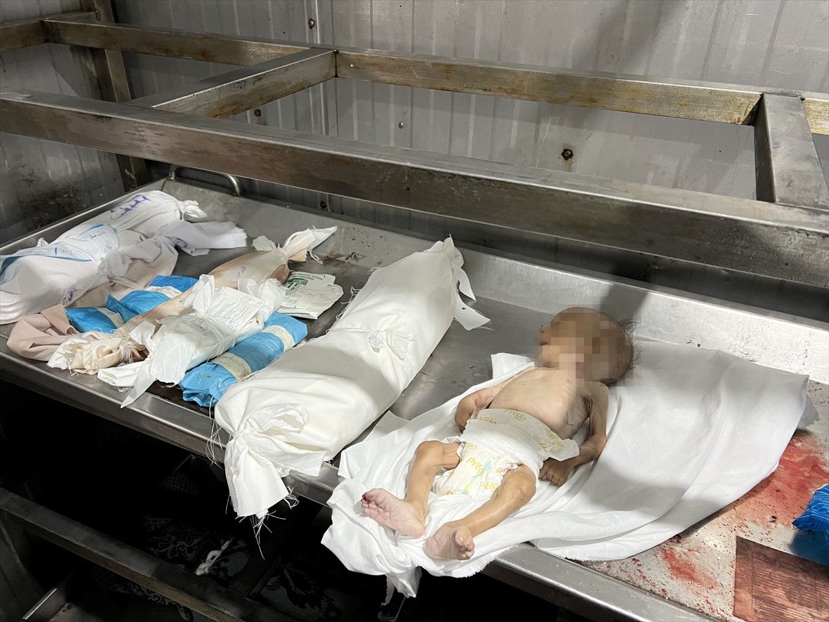 gazzede bir bebek daha acliktan oldu 2 KFHDNHzG