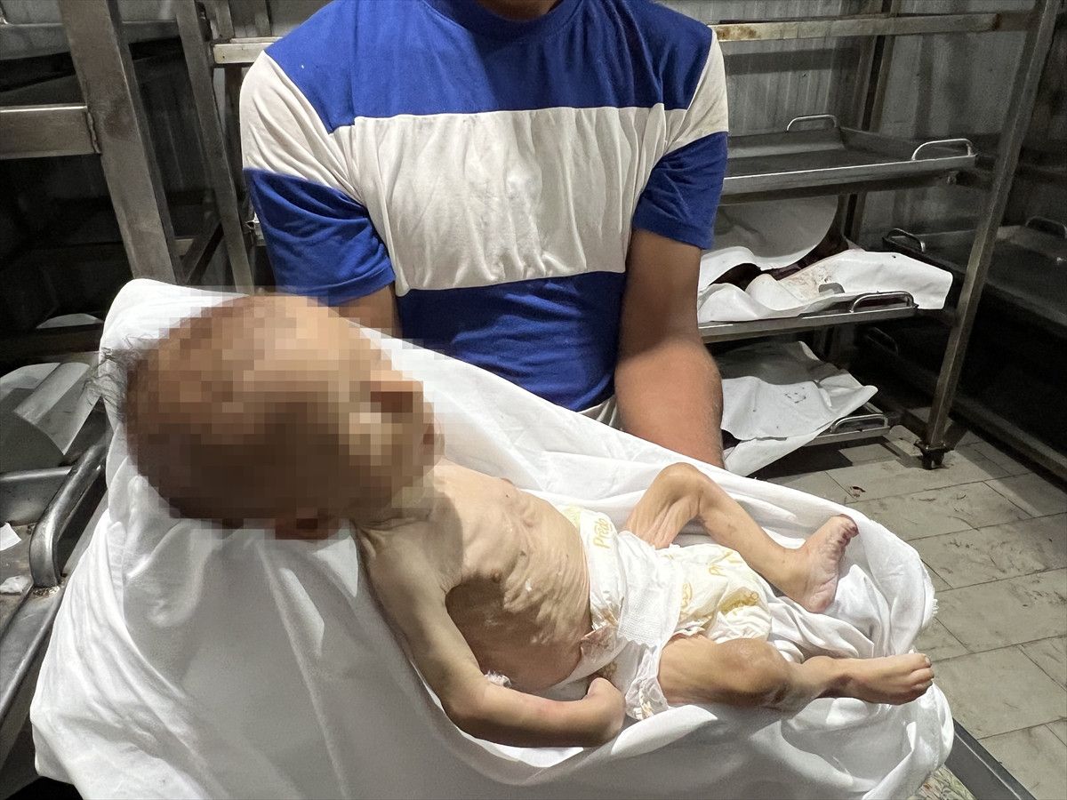 gazzede bir bebek daha acliktan oldu 3 uX7DNHqb