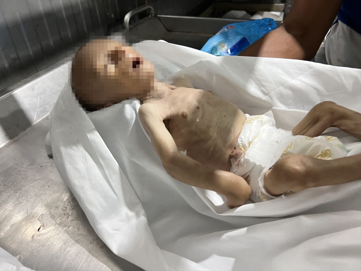 gazzede bir bebek daha acliktan oldu 4 N2nLfiOw