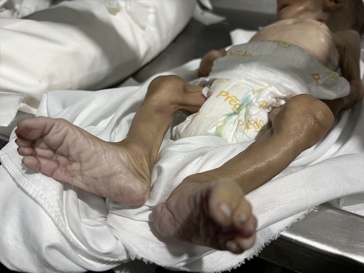 gazzede bir bebek daha acliktan oldu 6 bBgEdrbc