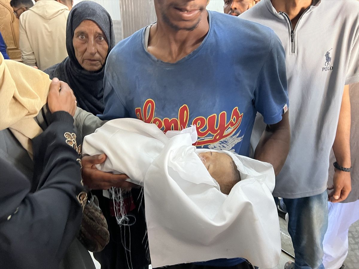 gazzede bir bebek daha acliktan oldu 8 QzLfmMfh