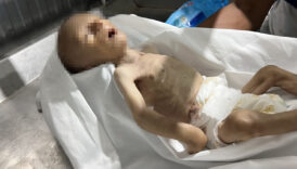 gazzede bir bebek daha acliktan oldu PVSO4fu8