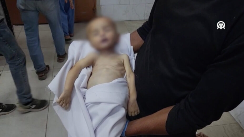 gazzede kitlik 3 bebek daha acliktan yasamini yitirdi nNdXvTUO