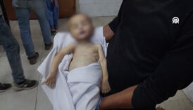 gazzede kitlik 3 bebek daha acliktan yasamini yitirdi nNdXvTUO