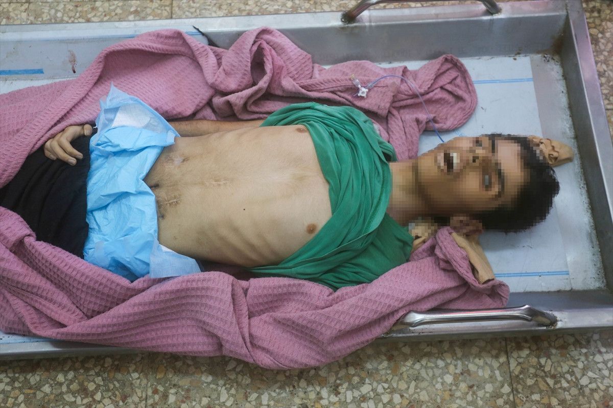 gazzede kitlik acliktan hayatini kaybedenlerin sayisi 455e yukseldi 0 fdEKO7Nw