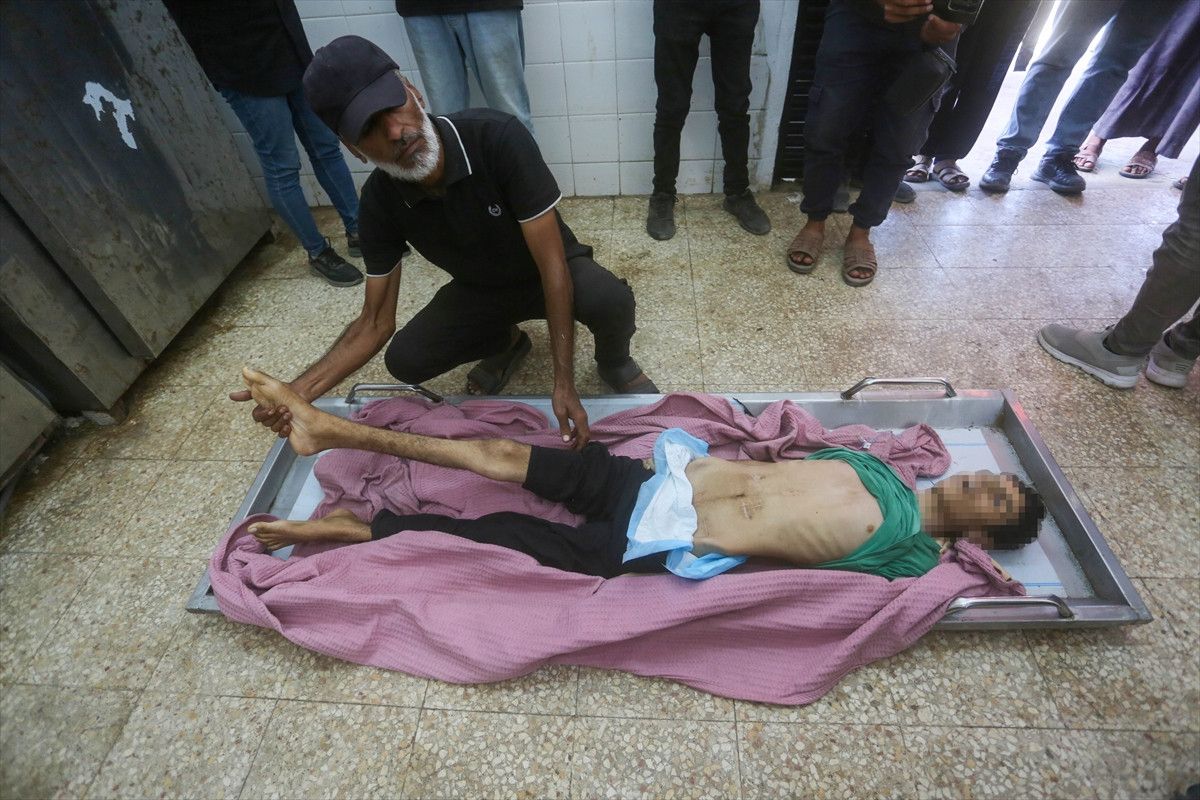 gazzede kitlik acliktan hayatini kaybedenlerin sayisi 455e yukseldi 1 CspluG2a