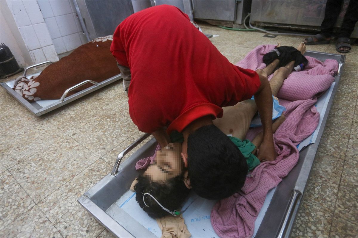 gazzede kitlik acliktan hayatini kaybedenlerin sayisi 455e yukseldi 2