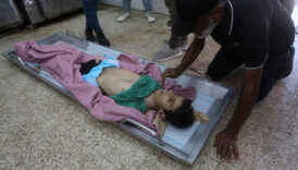 gazzede kitlik acliktan hayatini kaybedenlerin sayisi 455e yukseldi HHPmS932