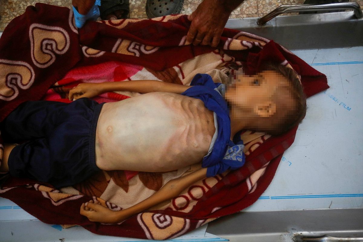 gazzede soykirim 8 yasindaki cocuk acliktan hayatini kaybetti 3 wlD5JrKI