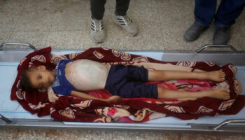 gazzede soykirim 8 yasindaki cocuk acliktan hayatini kaybetti p5UKNEJd