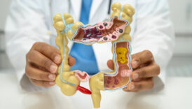 genc ve orta yas grubunda sikca rastlanan gizli tehdit apandisit kanseri rNrzgdg4