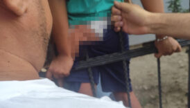 hatayda korkuluklara sikisan cocuk kurtarildi q56U4ELD