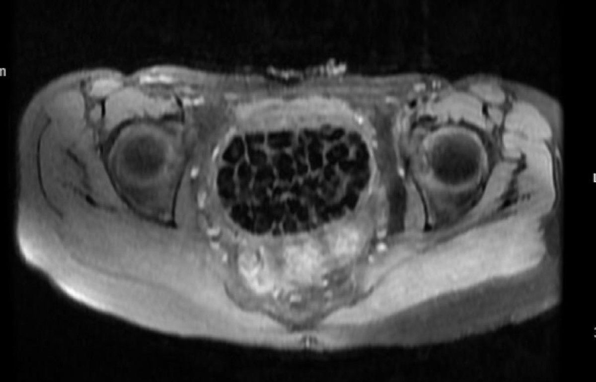 istanbulda karin agrisiyla doktora gitti vucudunda 287 tane tas cikti 3 IYhjGri9