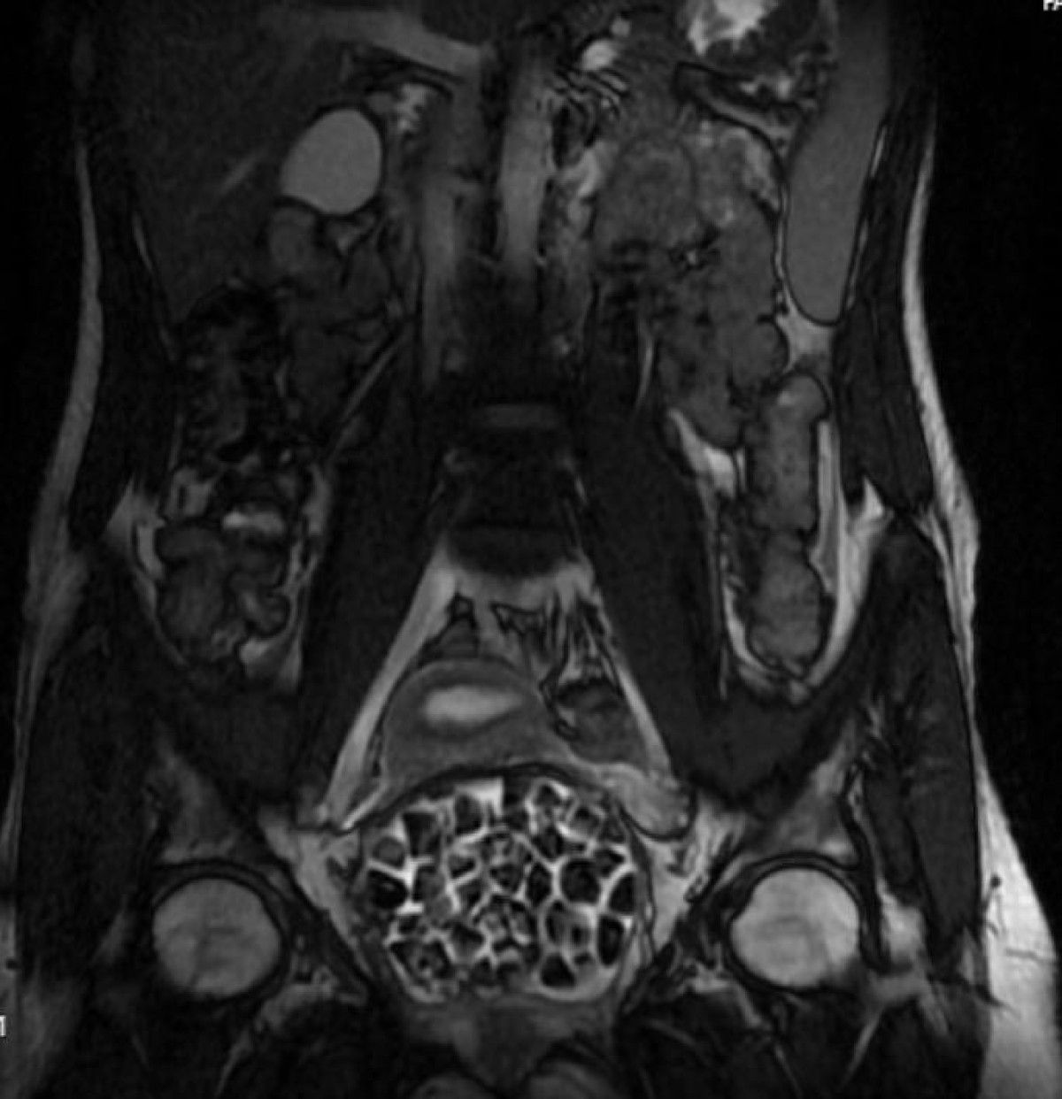 istanbulda karin agrisiyla doktora gitti vucudunda 287 tane tas cikti 7 LhVkKQHP