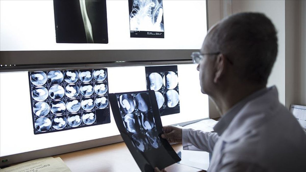 Sigara 16 kanser türüne sebep olabiliyor 1 sigara 16 kanser turune sebep olabiliyor 0 s4Zejlwp