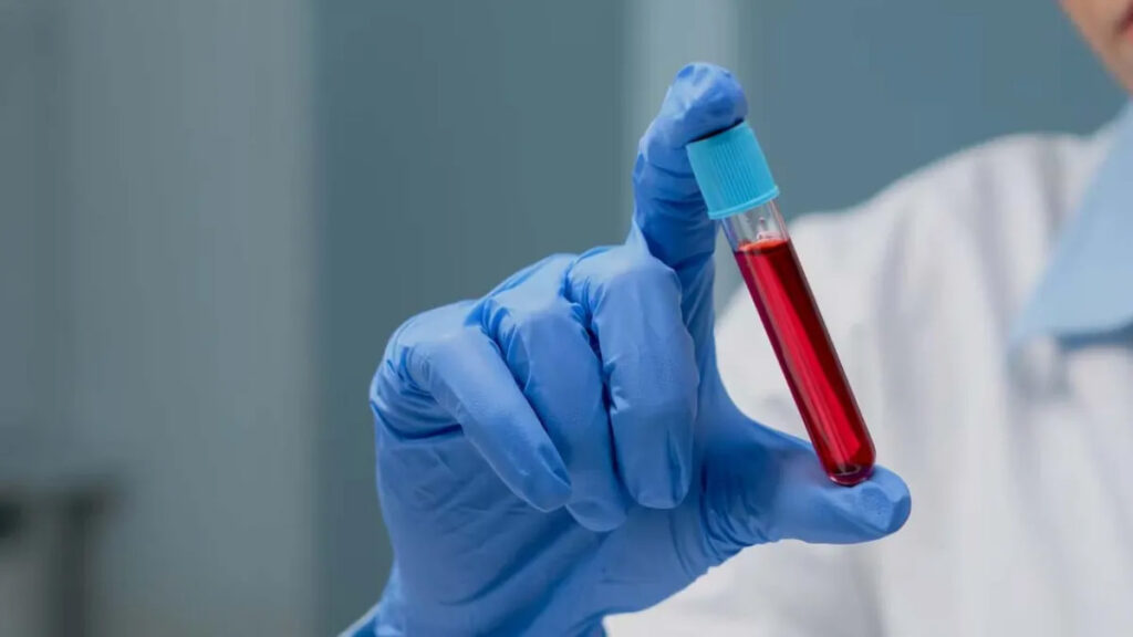 uzmanlar acikladi 0 a b ab kan grubu nasil beslenmeli iste uzak durulmasi gerekenler JIECEDwu