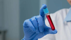 uzmanlar acikladi 0 a b ab kan grubu nasil beslenmeli iste uzak durulmasi gerekenler JIECEDwu