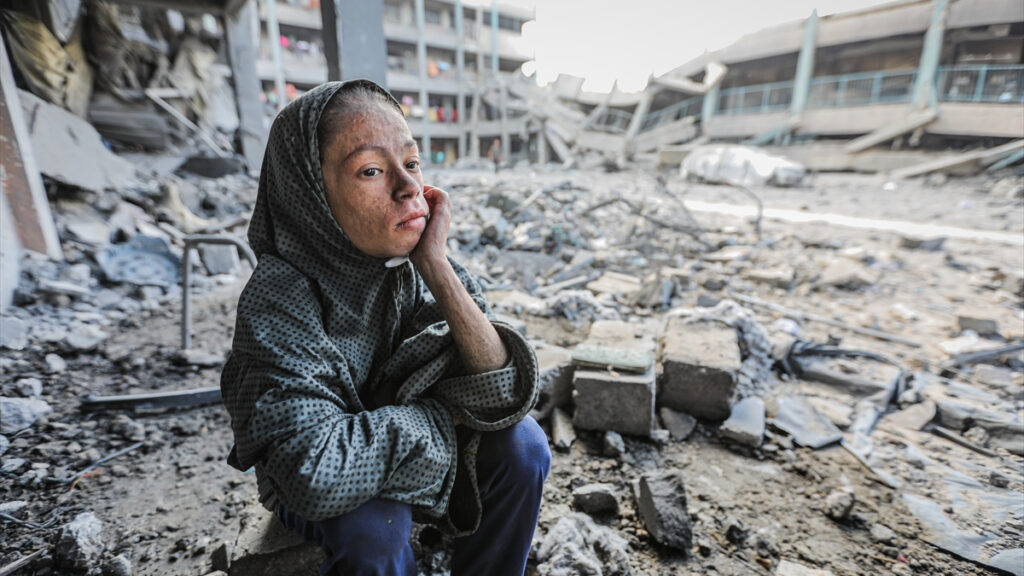 filistinli cocuklarin istekleri cikolata yemek okula gitmek tavuk yemek WIVZ5hRS