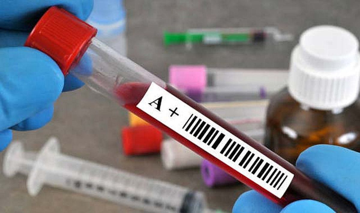 Kan grubuna göre en ideal meslekler belli oldu! A, B, 0 ve AB… 2 kan grubuna gore en ideal meslekler belli oldu a b 0 ve ab 1 Lym1AQQH