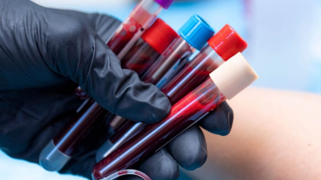 kan grubuna gore en ideal meslekler belli oldu a b 0 ve ab VqbHdwJK