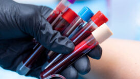 kan grubuna gore en ideal meslekler belli oldu a b 0 ve ab VqbHdwJK