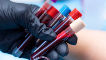 kan grubuna gore en ideal meslekler belli oldu a b 0 ve ab VqbHdwJK