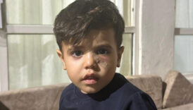 sanliurfada yorgun mermi cocugun gozunun altina isabet etti vOjcnLVl