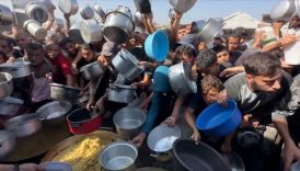 bm gazzede akut yetersiz beslenme vakasi 95 bine cikti RWa34kFP