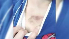 ibbye ait kresteki darp ve istismar iddialariyla ilgili tutuklama karari GLit9hEJ