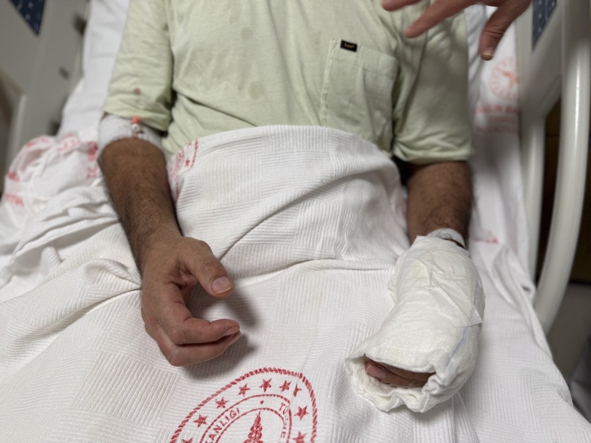 istanbulda sicak torbasi patlamasiyla vucudunun yuzde 30u yandi 0 ZqyaizYq