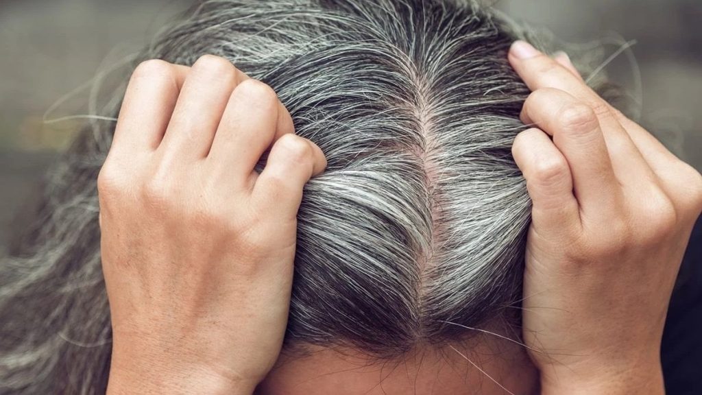 kuaforlerin gizli tutmak istedigi yontem beyaz saclar boyasiz nasil kapanir caagPKrE