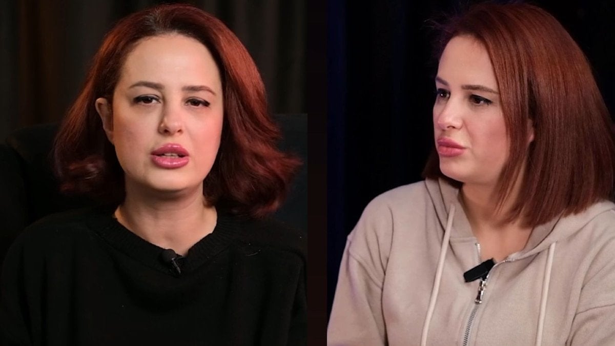 sagdan sola donat sozleriyle cin cikarmisti pelin hurman yillar sonra acildi iste son hali 8Lhm2NFR