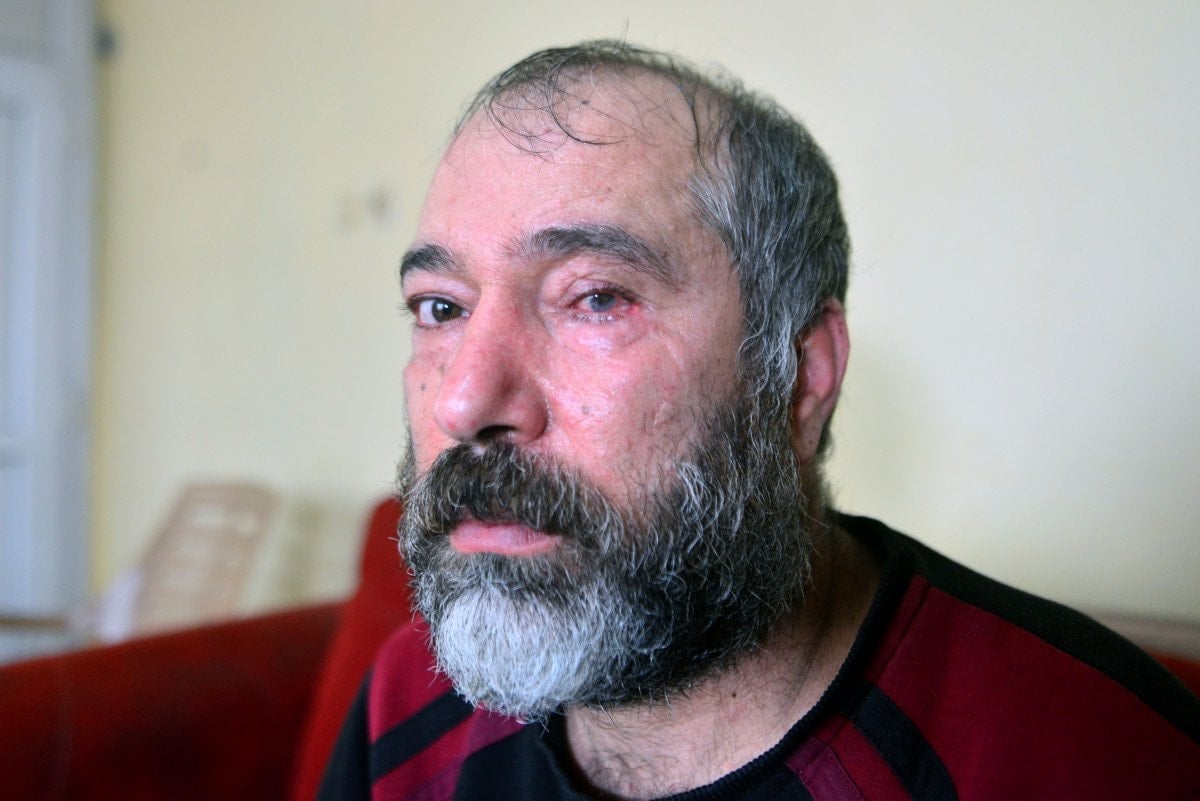 adanada dolmus soforune bardakli saldiri gozunu kaybetti 2 njcRmjAY