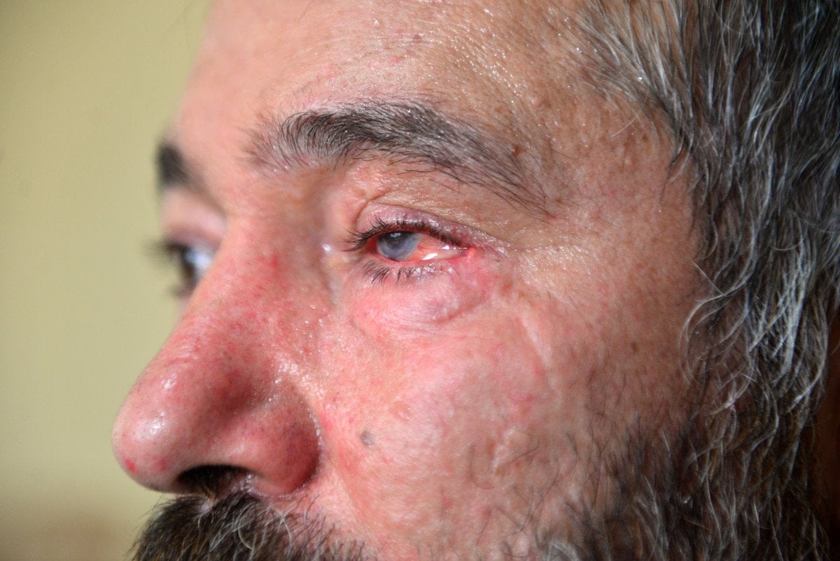 adanada dolmus soforune bardakli saldiri gozunu kaybetti 5 X2Y9ujE4